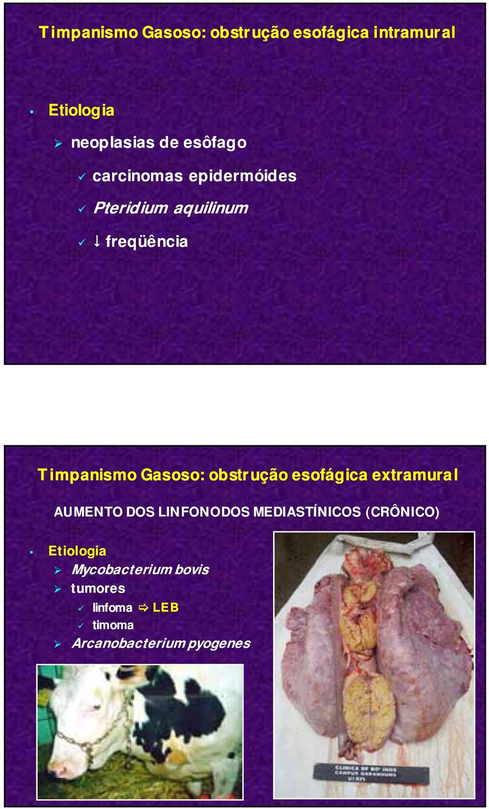 Gasoso: obstrução esofágica extramural AUMENTO DOS LINFONODOS MEDIASTÍNICOS