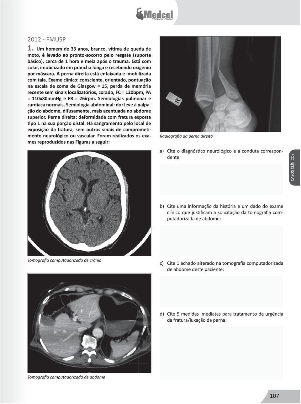 Exame clínico: consciente, orientado, pontuação na escala de coma de Glasgow = 15, perda de memória recente sem sinais localizatórios, corado, FC = 120bpm, PA = 110x80mmHg e FR = 26irpm.