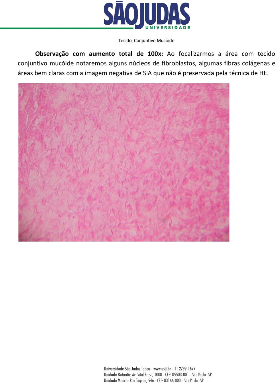 núcleos de fibroblastos, algumas fibras colágenas e áreas bem