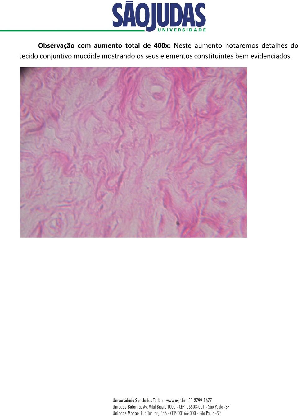 tecido conjuntivo mucóide mostrando os