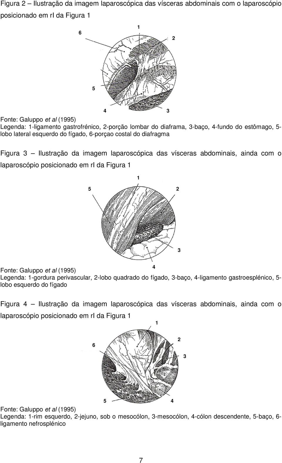 laparoscópio posicionado em ri da Figura 1 1 5 2 3 4 Fonte: Galuppo et al (1995) Legenda: 1-gordura perivascular, 2-lobo quadrado do fígado, 3-baço, 4-ligamento gastroesplénico, 5- lobo esquerdo do