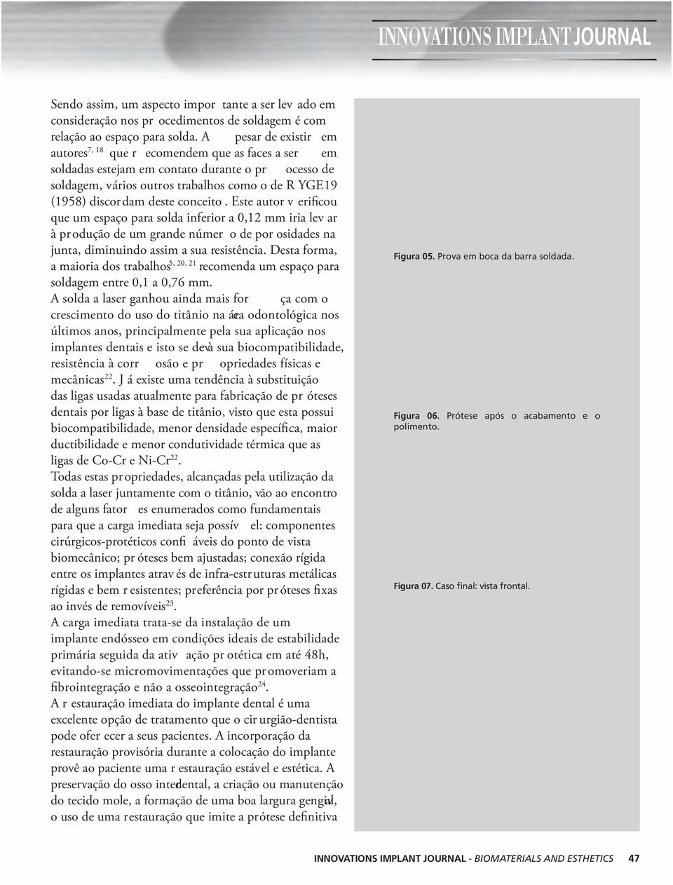 conceito. Este autor v erificou que um espaço para solda inferior a 0,12 mm iria lev ar à produção de um grande númer o de por osidades na junta, diminuindo assim a sua resistência.