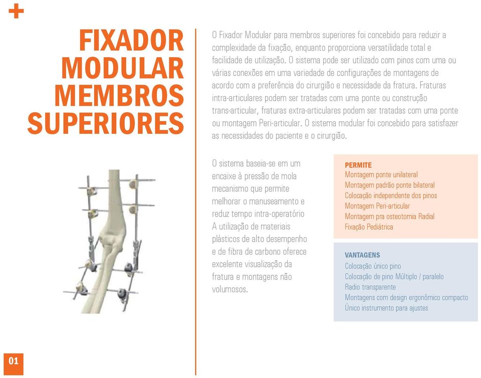 Fraturas intra-articulares podem ser tratadas com uma ponte ou construção trans-articular, fraturas extra-articulares podem ser tratadas com uma ponte ou montagem Peri-articular.