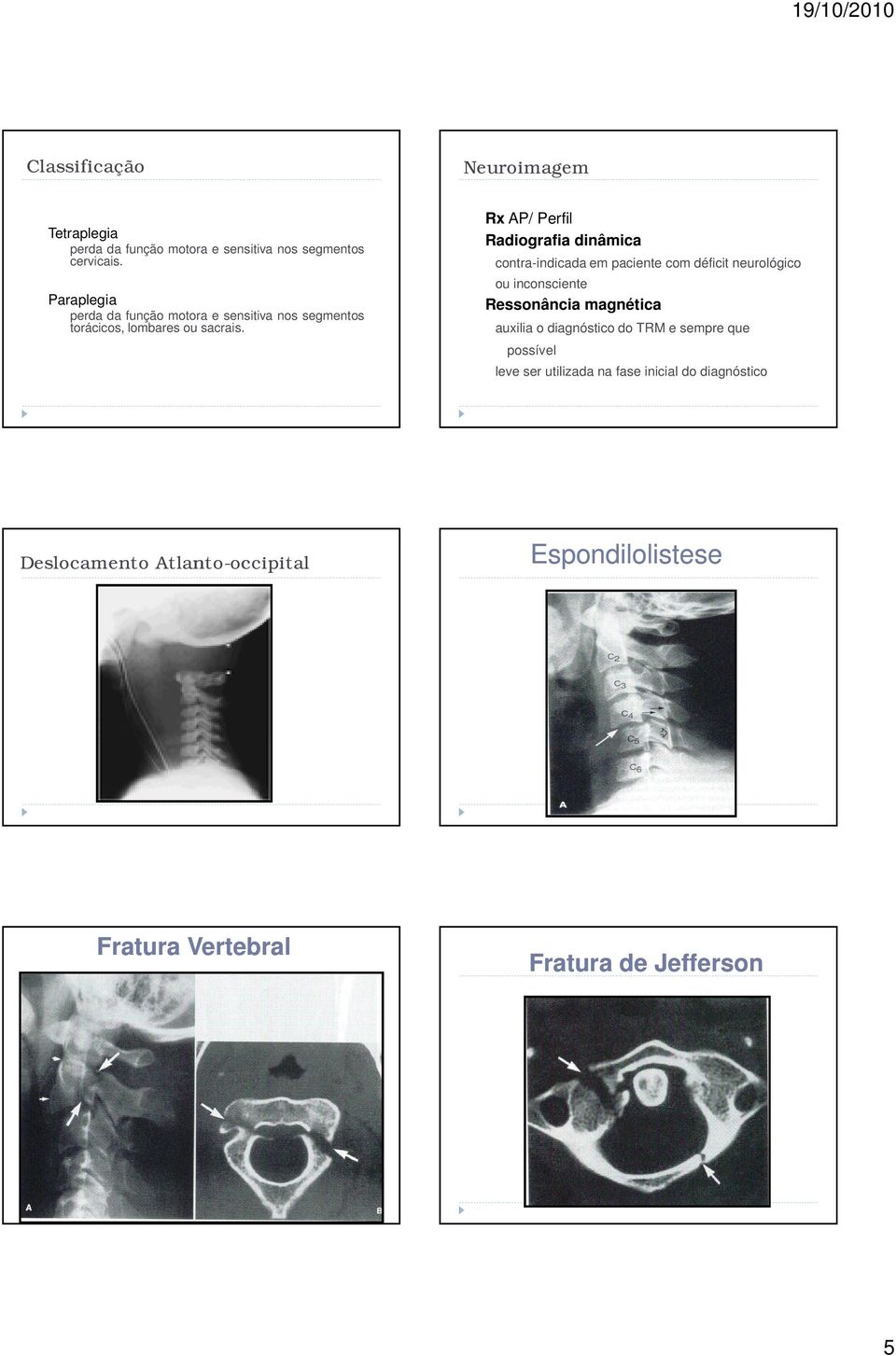 - Rx AP/ Perfil - Radiografia dinâmica contra-indicada em paciente com déficit neurológico ou inconsciente - Ressonância