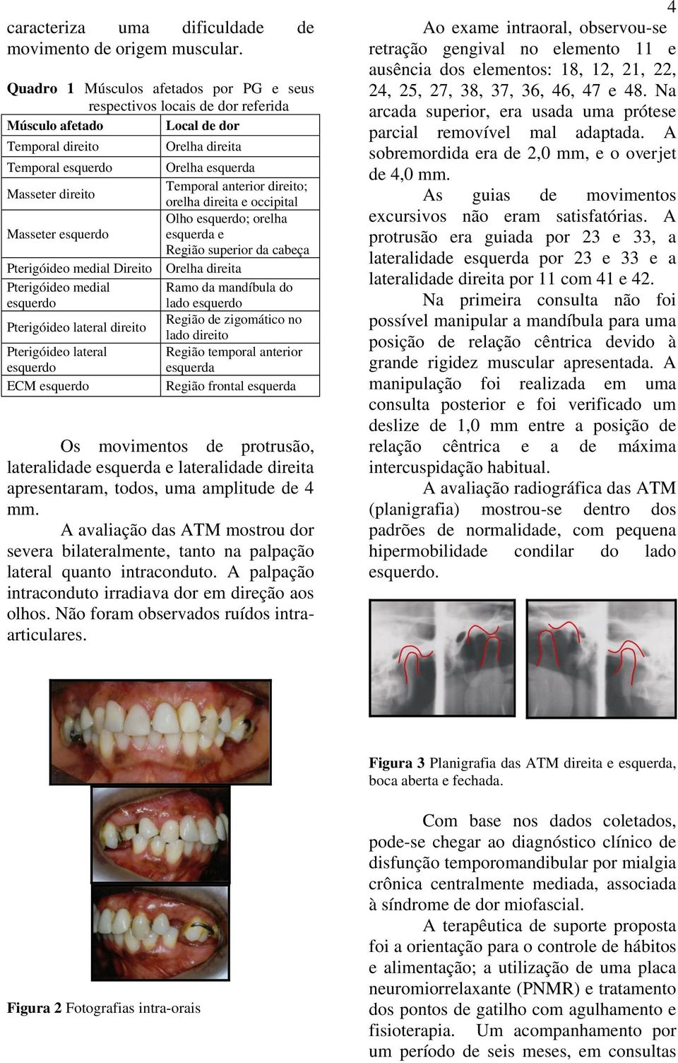 Direito Pterigóideo medial esquerdo Pterigóideo lateral direito Pterigóideo lateral esquerdo ECM esquerdo Orelha direita Orelha esquerda Temporal anterior direito; orelha direita e occipital Olho