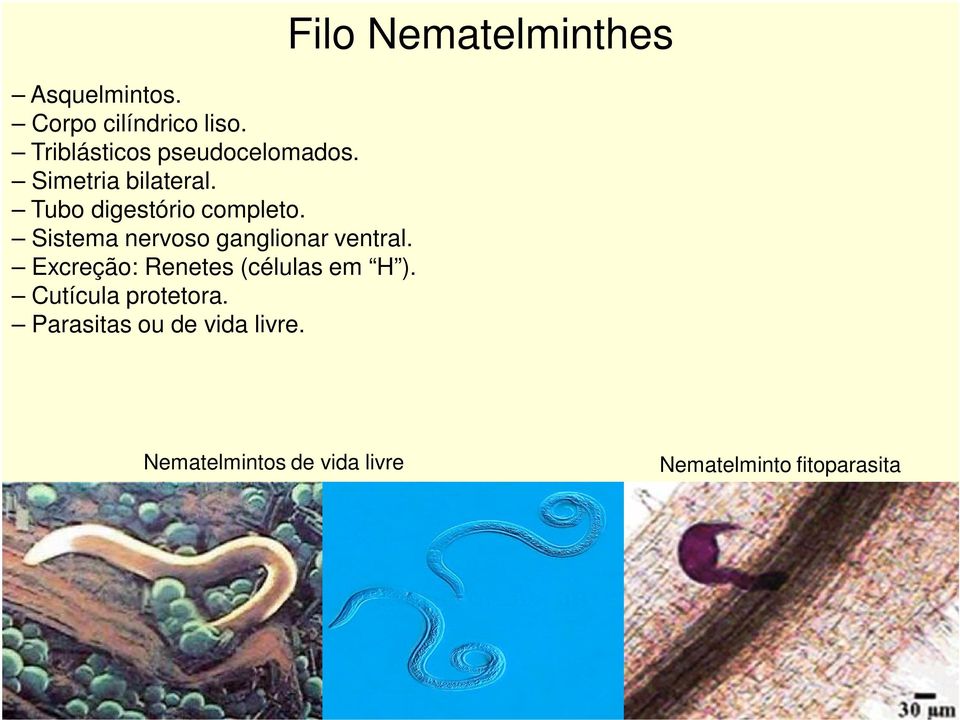 Sistema nervoso ganglionar ventral. Excreção: Renetes (células em H ).