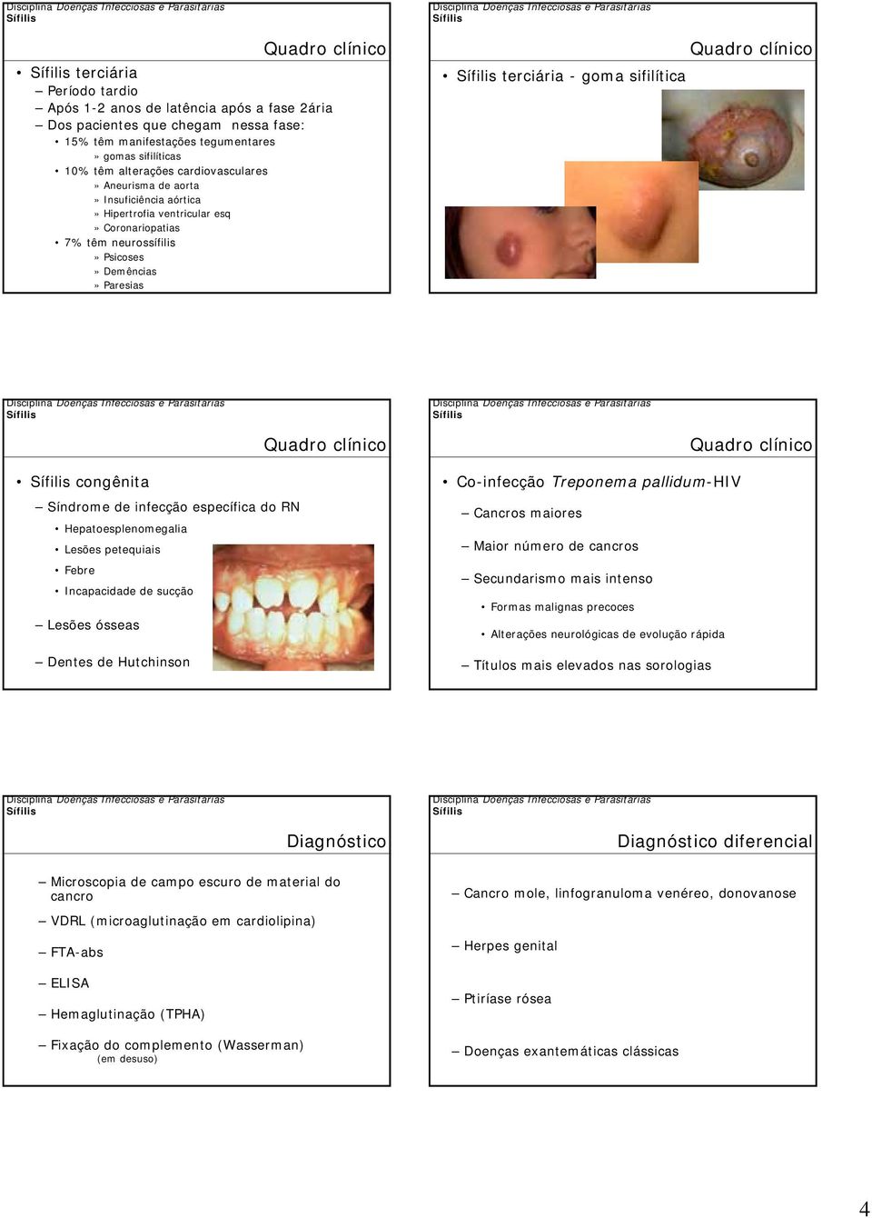 específica do RN Hepatoesplenomegalia Lesões petequiais Febre Incapacidade de sucção Lesões ósseas Dentes de Hutchinson Co-infecção Treponema pallidum-hiv Cancros maiores Maior número de cancros