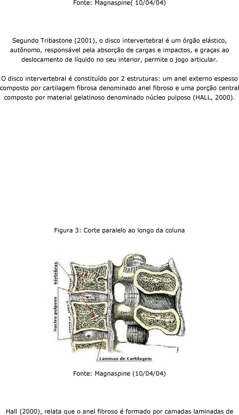 O disco intervertebral é constituído por 2 estruturas: um anel externo espesso composto por cartilagem fibrosa denominado anel fibroso e uma porção