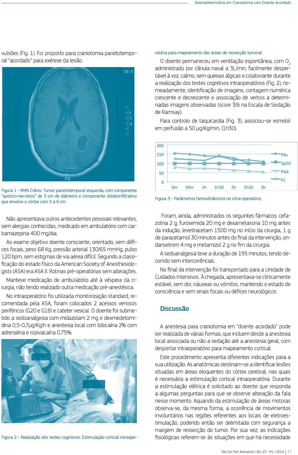 O doente permaneceu em ventilação espontânea, com O 2 administrado por cânula nasal a 3L/min, facilmente despertável à voz, calmo, sem queixas álgicas e colaborante durante a realização dos testes