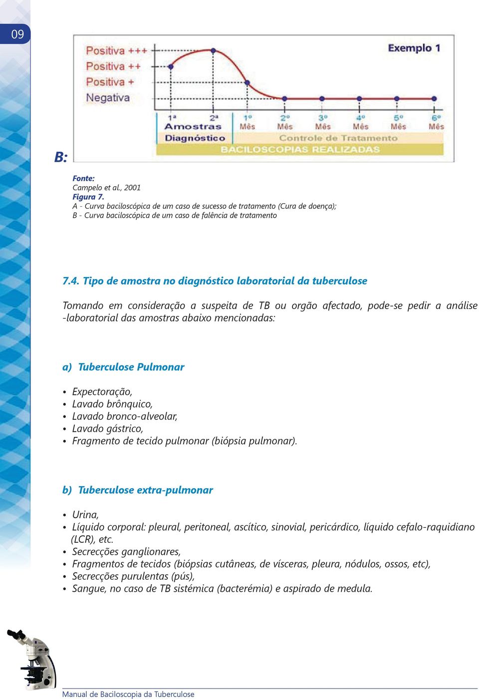 Tuberculose Pulmonar Expectoração, Lavado brônquico, Lavado bronco-alveolar, Lavado gástrico, Fragmento de tecido pulmonar (biópsia pulmonar).