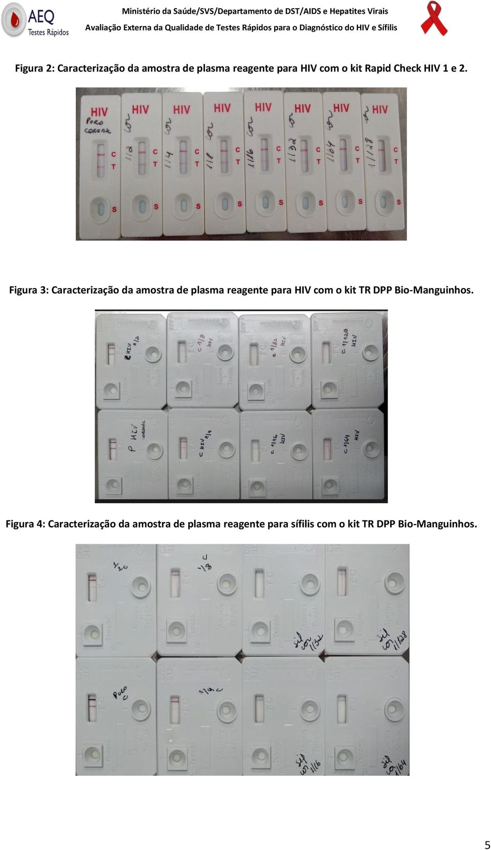 Figura 3: Caracterização da amostra de plasma reagente para HIV com o kit