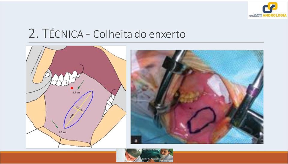 Colheita