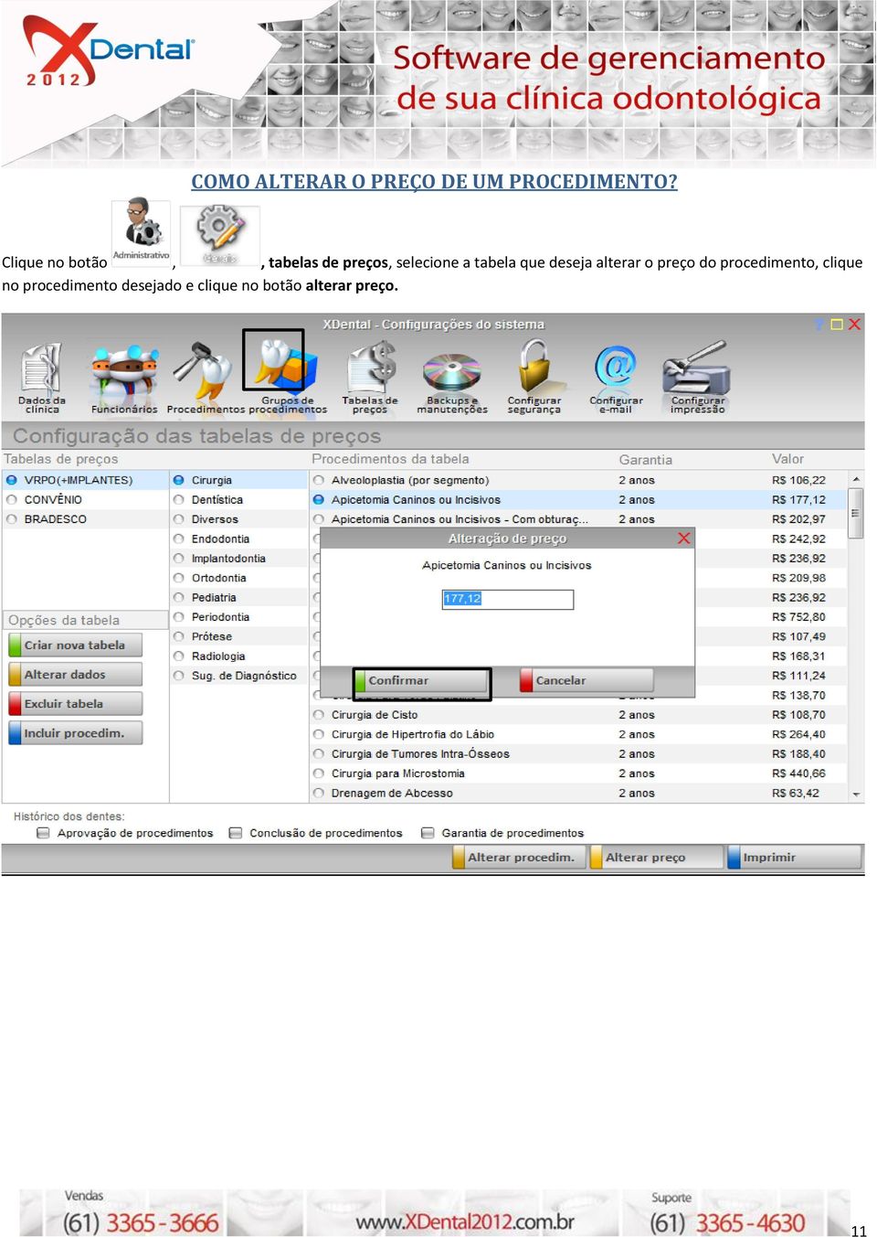 tabela que deseja alterar o preço do procedimento,