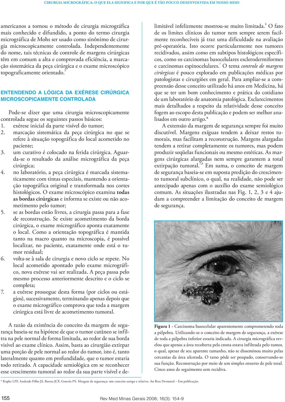 topograficamente orientado. 5 ENTENDENDO A LÓGICA DA EXÉRESE CIRÚRGICA MICROSCOPICAMENTE CONTROLADA Pode-se dizer que uma cirurgia microscopicamente controlada segue os seguintes passos básicos: 1.