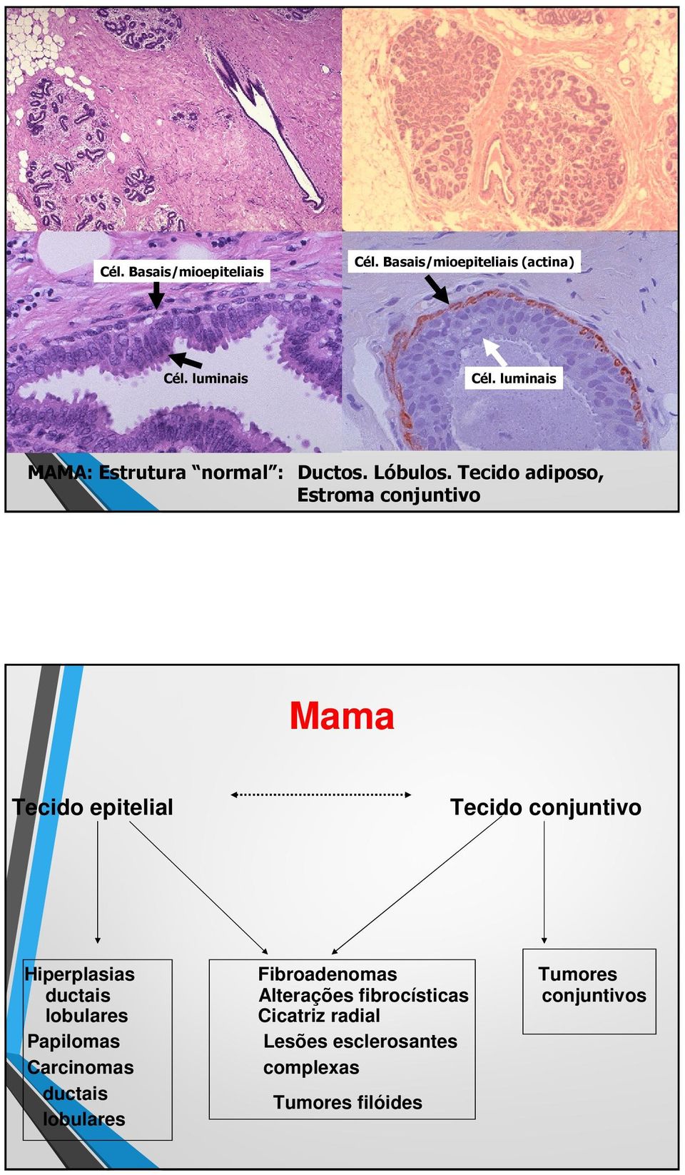 Tecido adiposo, Estroma conjuntivo Mama Tecido epitelial Tecido conjuntivo Hiperplasias