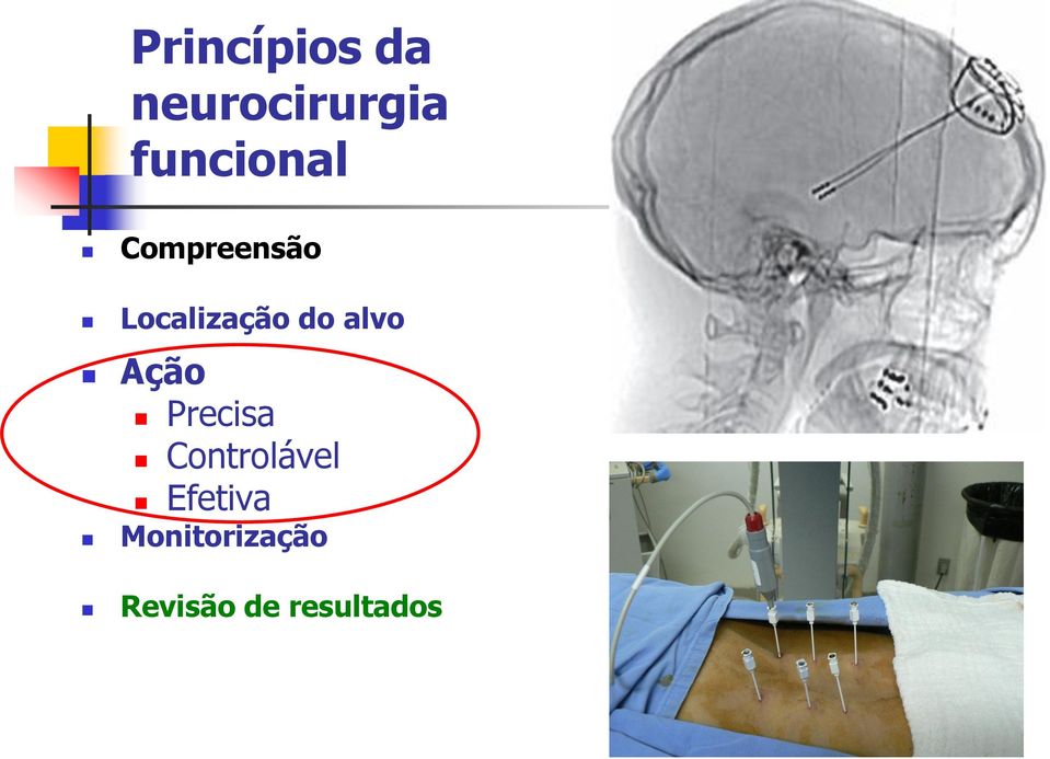 do alvo Ação Precisa Controlável