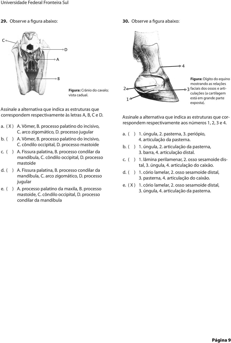 ( ) A. Vômer, B. processo palatino do incisivo, C. côndilo occipital, D. processo mastoide c. ( ) A. Fissura palatina, B. processo condilar da mandíbula, C. côndilo occipital, D. processo mastoide d.