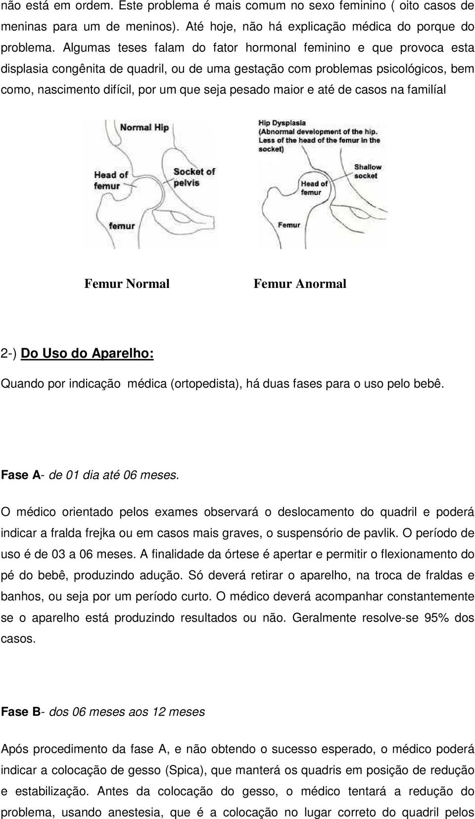 maior e até de casos na familíal Femur Normal Femur Anormal 2-) Do Uso do Aparelho: Quando por indicação médica (ortopedista), há duas fases para o uso pelo bebê. Fase A- de 01 dia até 06 meses.