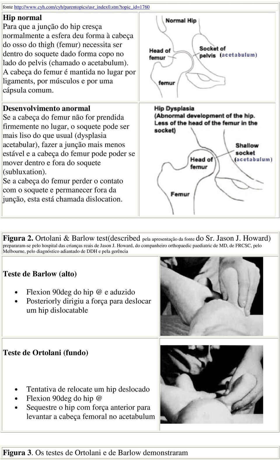 acetabulum). A cabeça do femur é mantida no lugar por ligaments, por músculos e por uma cápsula comum.