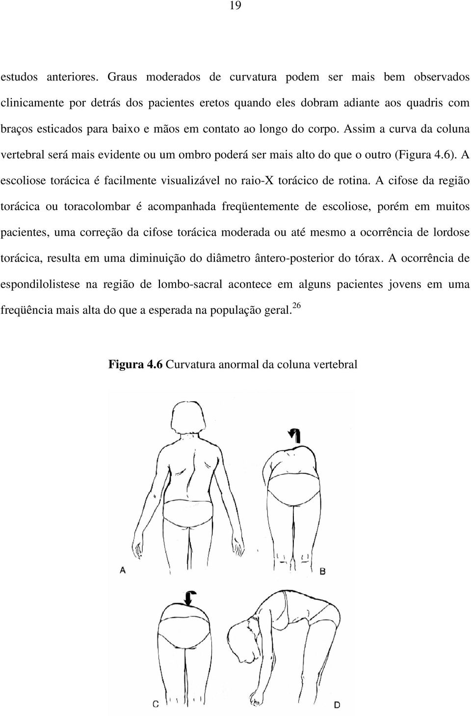 longo do corpo. Assim a curva da coluna vertebral será mais evidente ou um ombro poderá ser mais alto do que o outro (Figura 4.6).