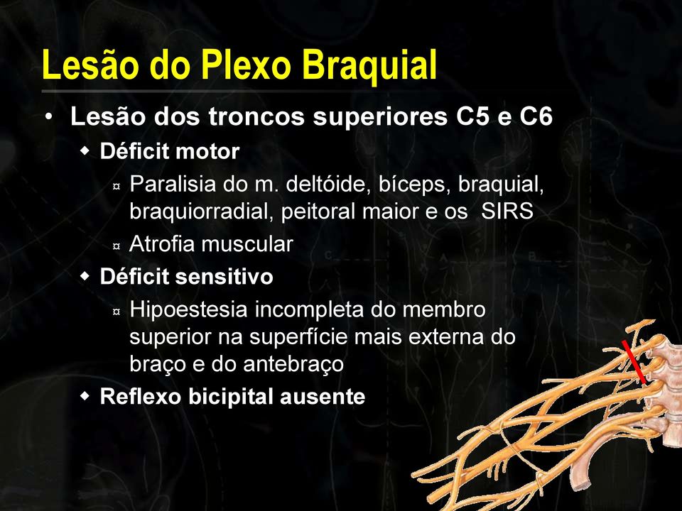 deltóide, bíceps, braquial, braquiorradial, peitoral maior e os SIRS Atrofia