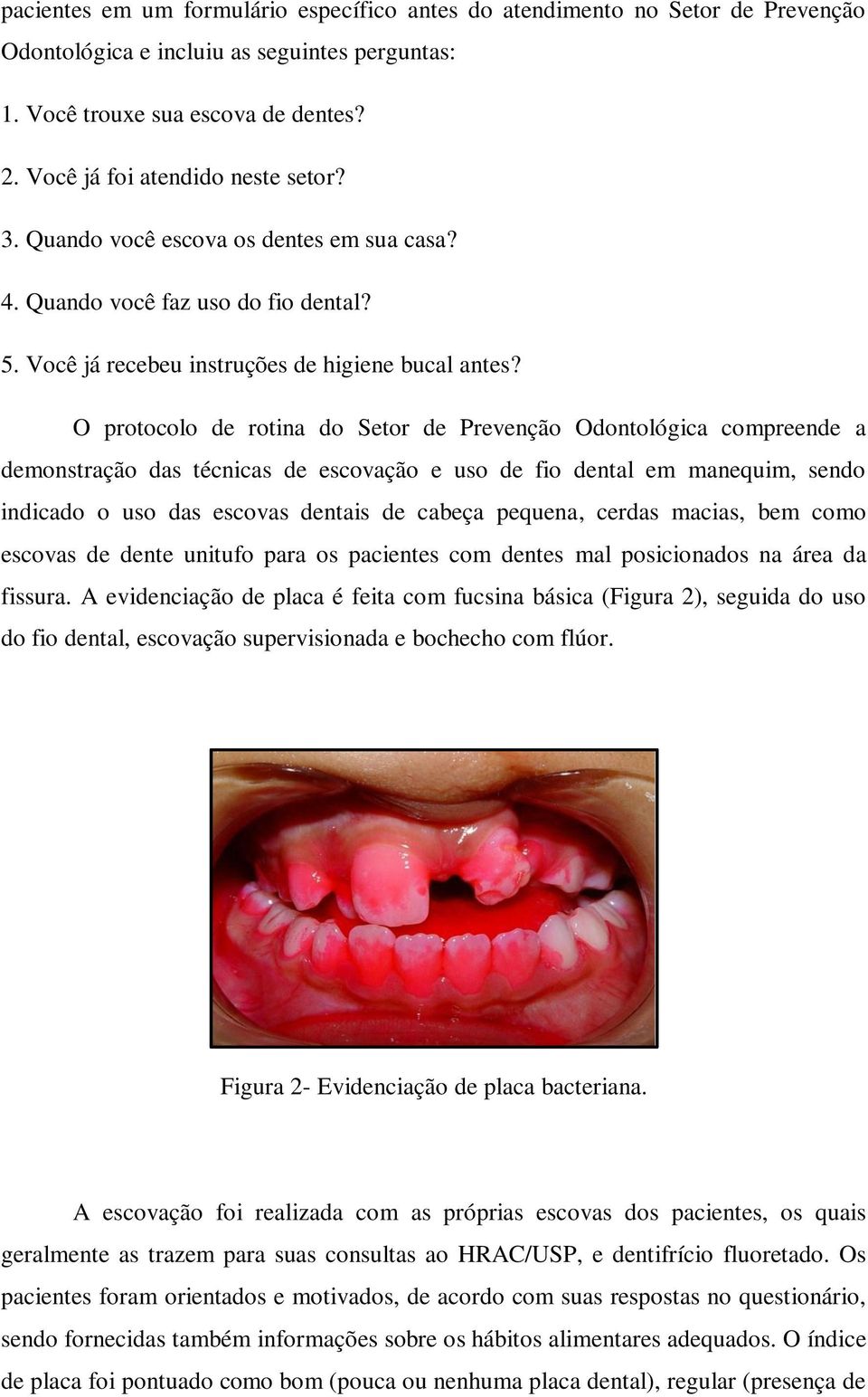 O protocolo de rotina do Setor de Prevenção Odontológica compreende a demonstração das técnicas de escovação e uso de fio dental em manequim, sendo indicado o uso das escovas dentais de cabeça