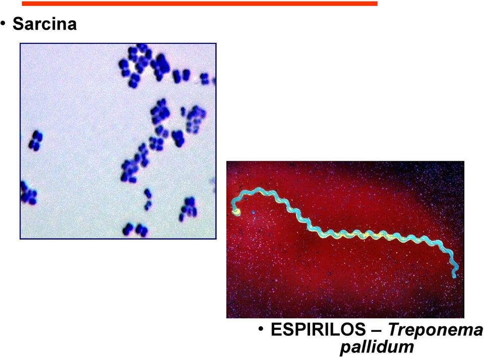 Treponema