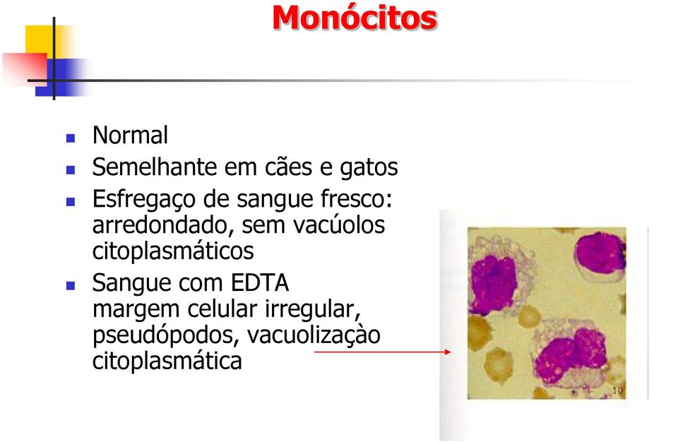 vacúolos citoplasmáticos Sangue com EDTA margem