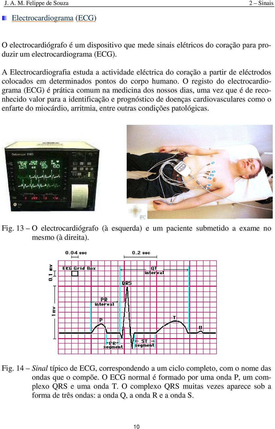 O regist d electrcardigrama (ECG) é prática cmum na medicina ds nsss dias, uma vez que é de recnhecid valr para a identificaçã e prgnóstic de denças cardivasculares cm enfarte d micárdi, arritmia,