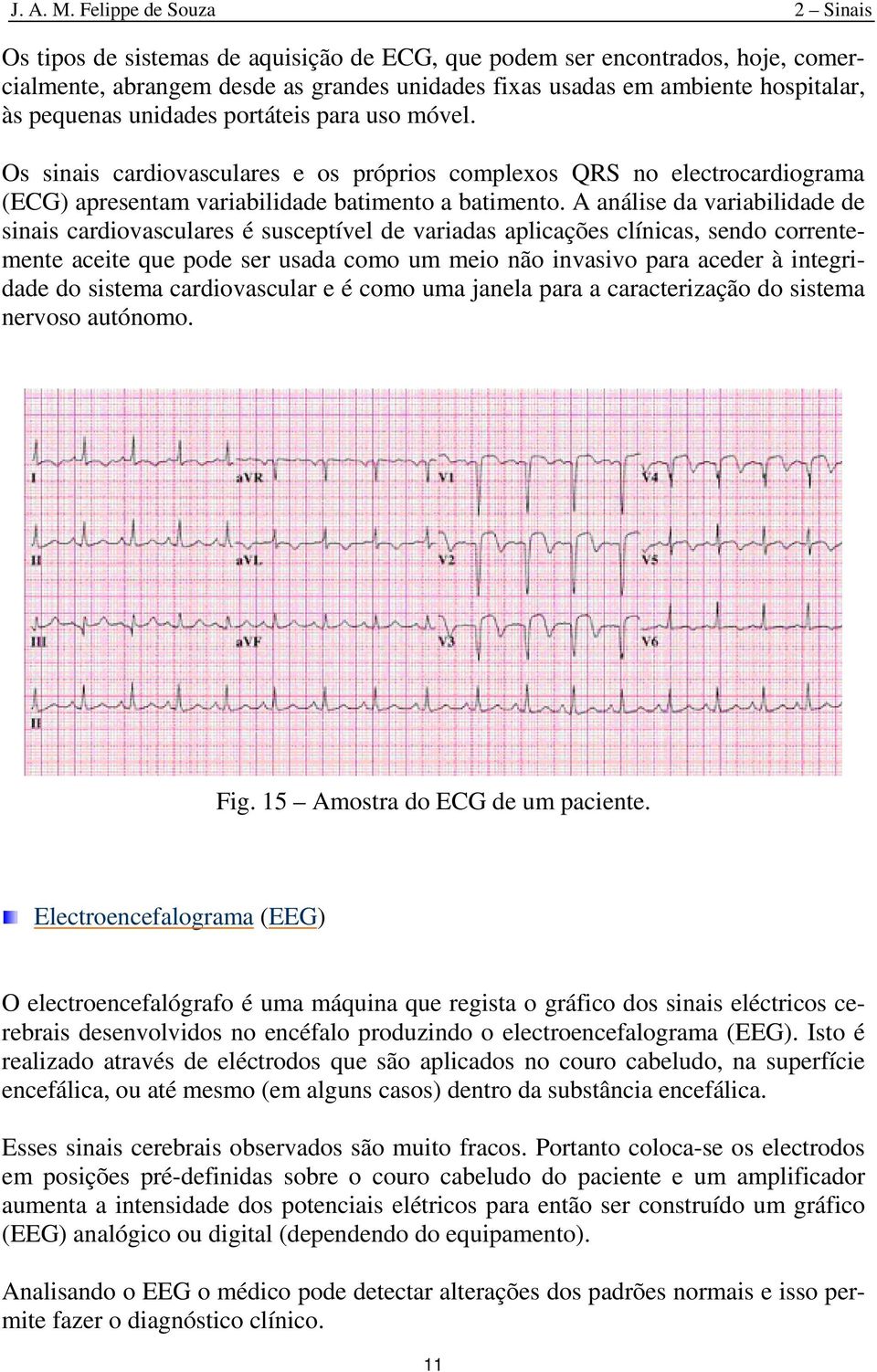 prtáteis para us móvel. Os sinais cardivasculares e s própris cmplexs QRS n electrcardigrama (ECG) apresentam variabilidade batiment a batiment.