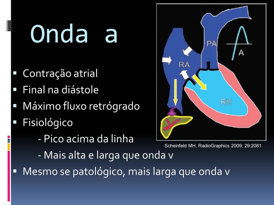 Mais alta e larga que onda v Scheinfeld MH.