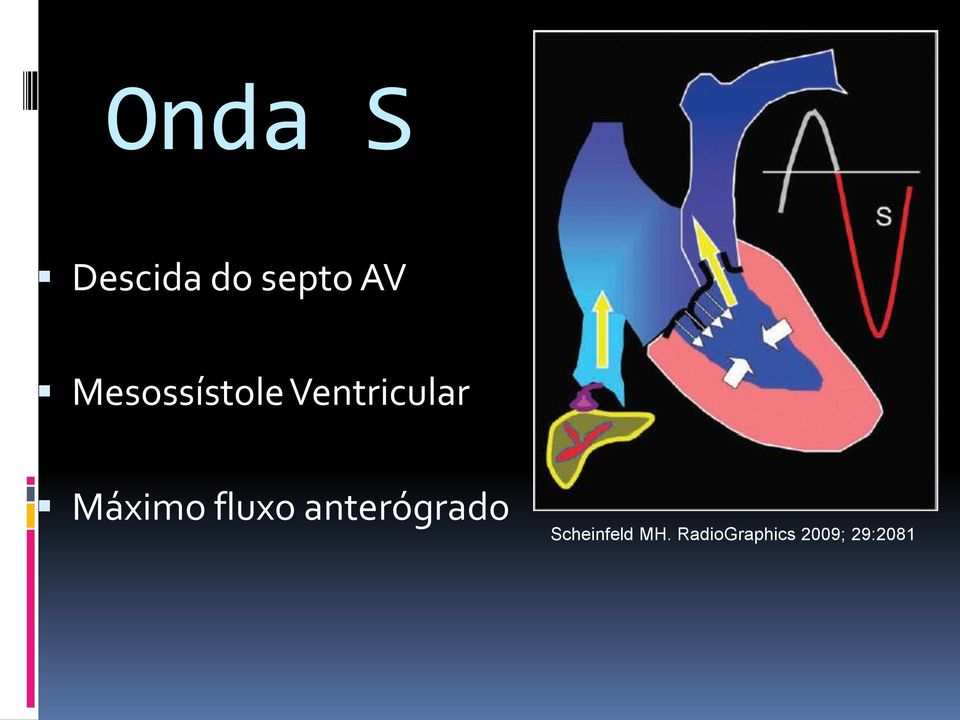 Máximo fluxo anterógrado