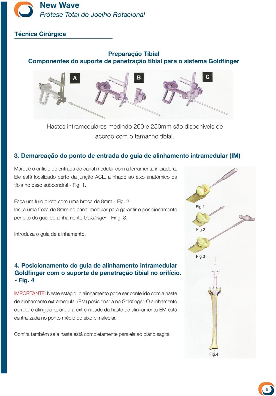 Ele está localizado perto da junção ACL, alinhado ao eixo anatômico da tíbia no osso subcondral - Fig. 1. Faça um furo piloto com uma broca de 8mm - Fig. 2.