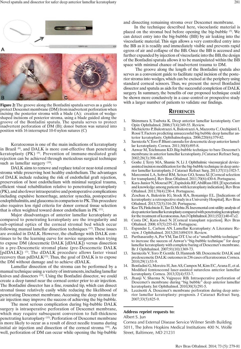 The spatula serves to protect inadvertent perforation of DM (B); donor button was sutured into position with 16 interrupted 10-0 nylon sutures (C) Keratoconus is one of the main indications of