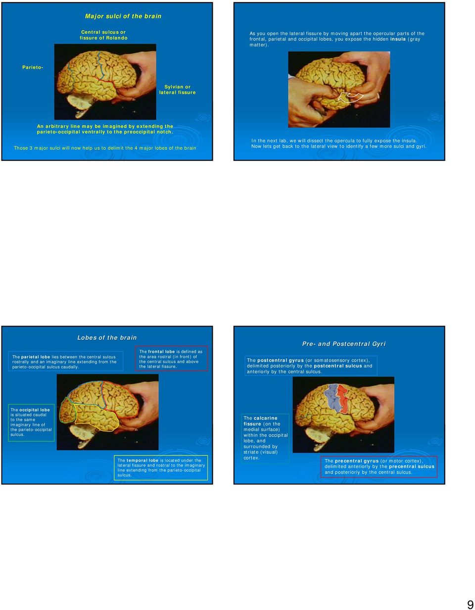 Those 3 major sulci will now help us to delimit the 4 major lobes of the brain In the next lab, we will dissect the opercula to fully expose the insula.