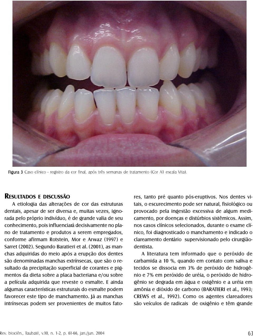 influenciará decisivamente no plano de tratamento e produtos a serem empregados, conforme afirmam Rotstein, Mor e Arwaz (1997) e Sarret (2002). Segundo Baratieri et al.