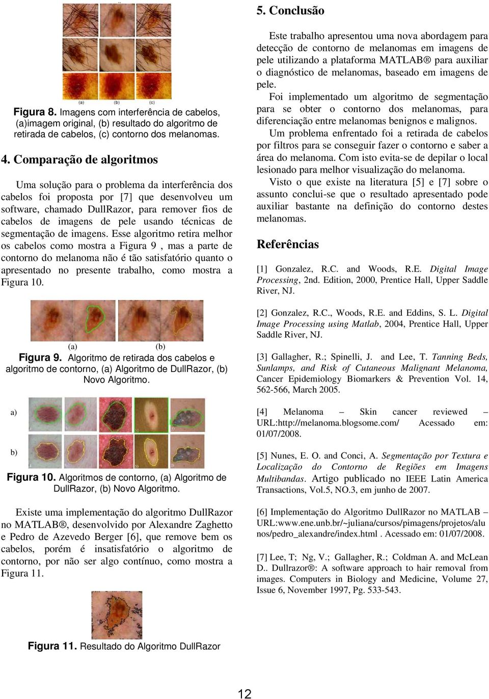 usando técnicas de segmentação de imagens.