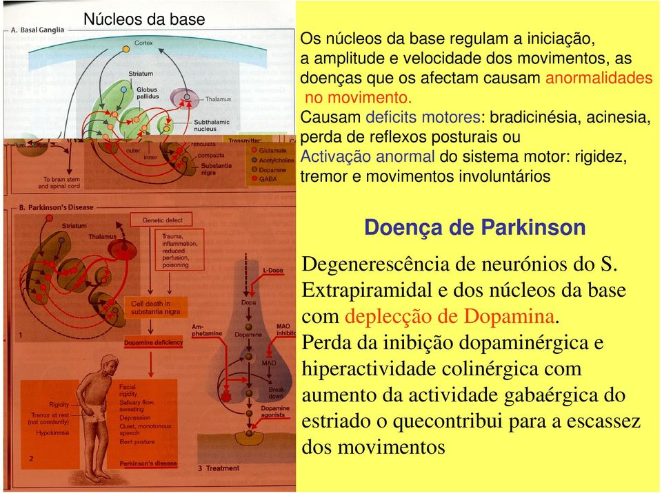 Causam deficits motores: bradicinésia, acinesia, perda de reflexos posturais ou Activação anormal do sistema motor: rigidez, tremor e movimentos