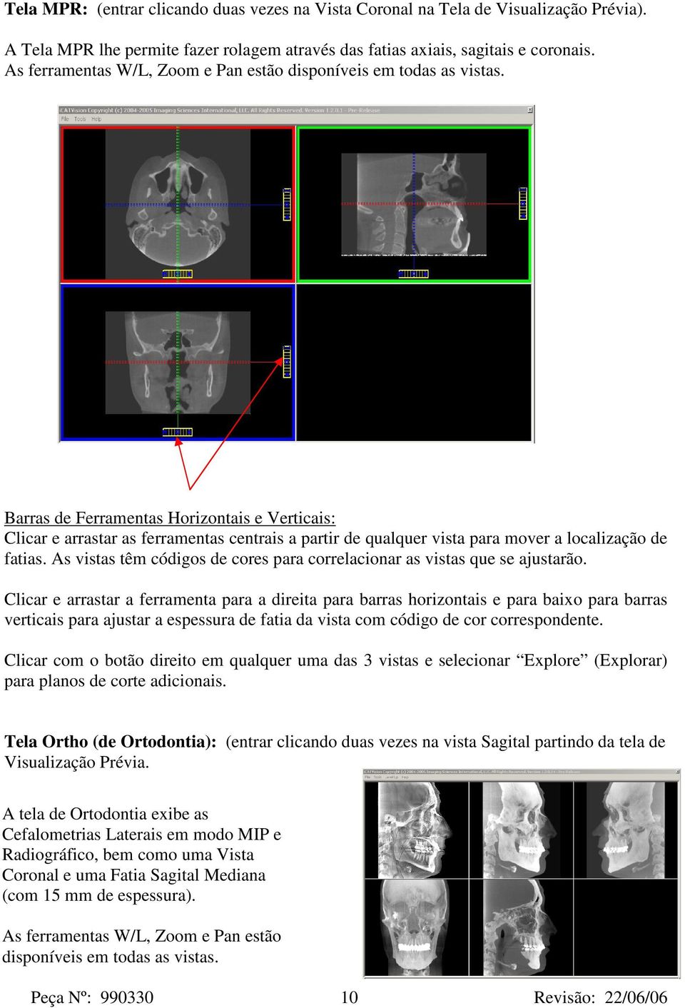 Barras de Ferramentas Horizontais e Verticais: Clicar e arrastar as ferramentas centrais a partir de qualquer vista para mover a localização de fatias.