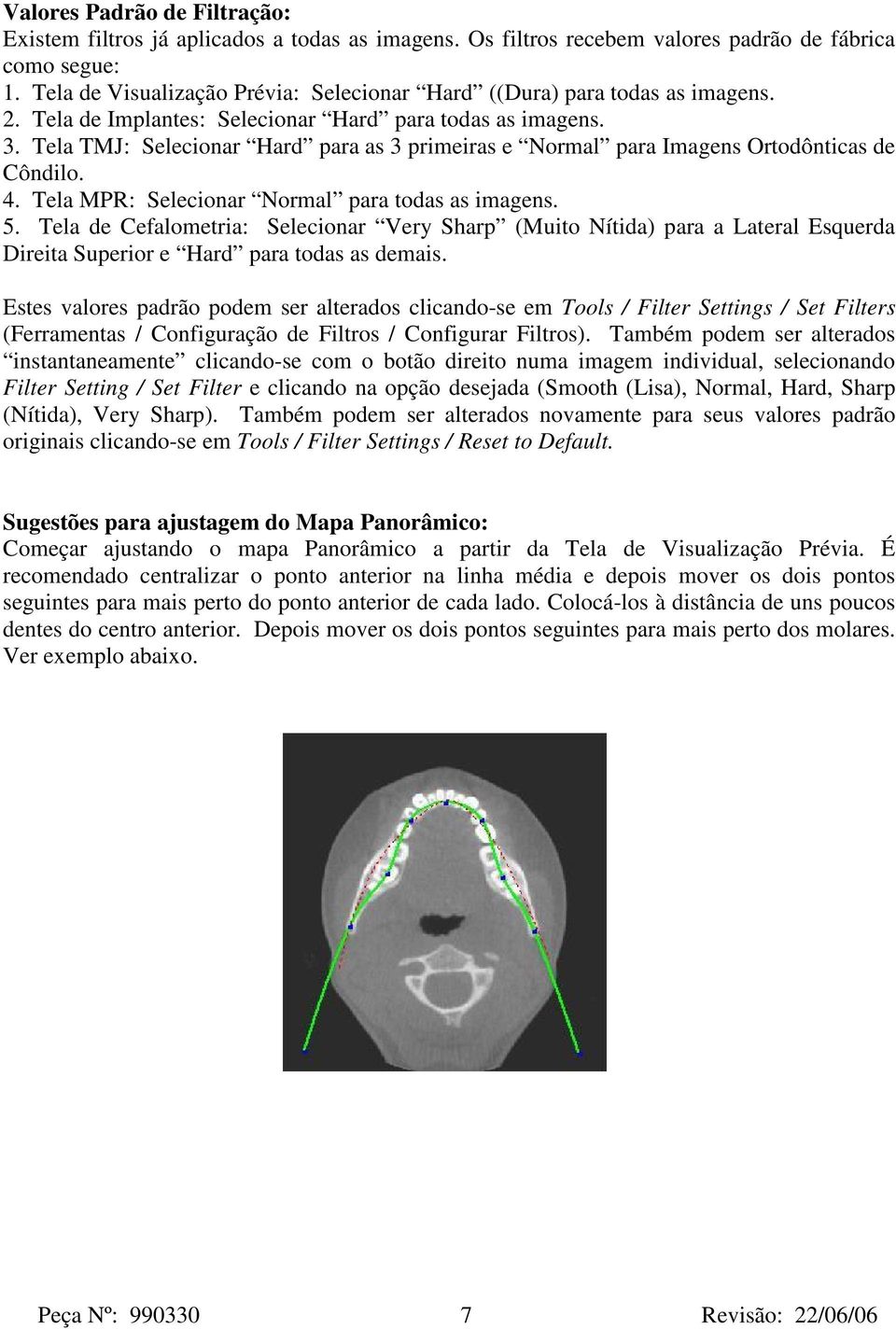 Tela TMJ: Selecionar Hard para as 3 primeiras e Normal para Imagens Ortodônticas de Côndilo. 4. Tela MPR: Selecionar Normal para todas as imagens. 5.