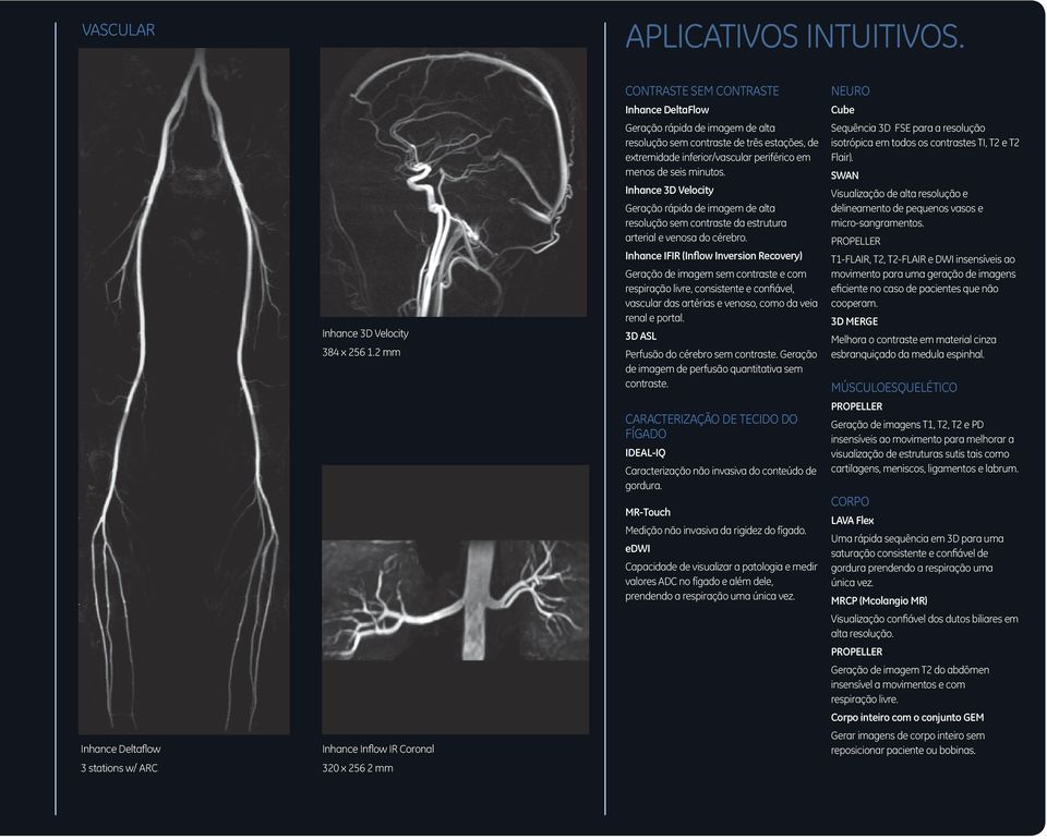 periférico em menos de seis minutos. Inhance 3D Velocity Geração rápida de imagem de alta resolução sem contraste da estrutura arterial e venosa do cérebro.