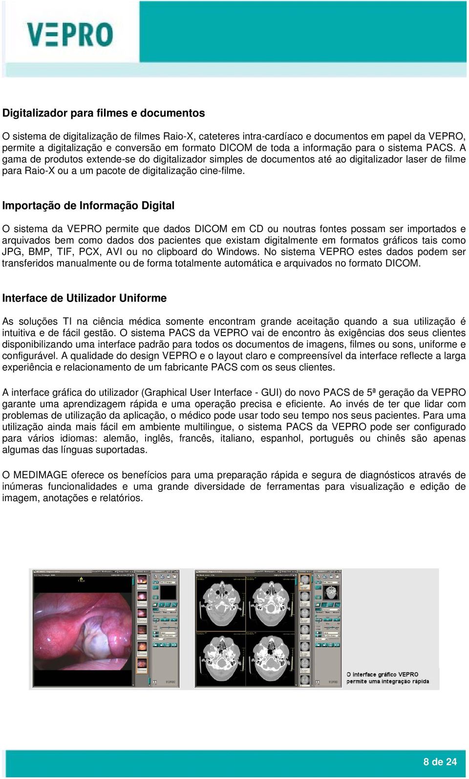 Importação de Informação Digital O sistema da VEPRO permite que dados DICOM em CD ou noutras fontes possam ser importados e arquivados bem como dados dos pacientes que existam digitalmente em