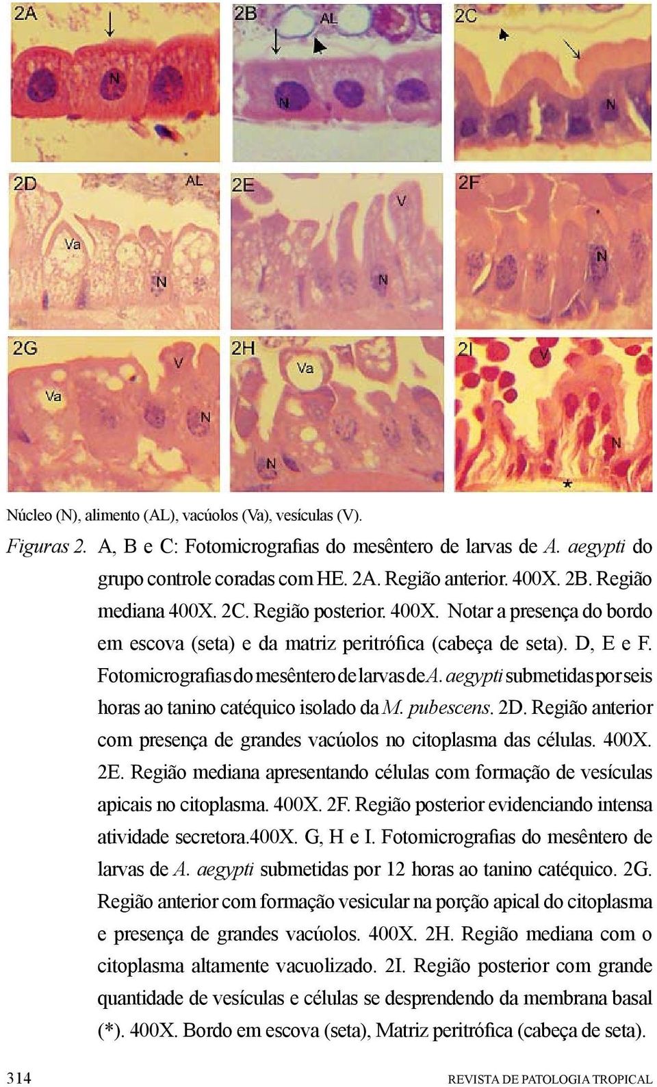 aegypti submetidas por seis horas ao tanino catéquico isolado da M. pubescens. 2D. Região anterior com presença de grandes vacúolos no citoplasma das células. 400X. 2E.