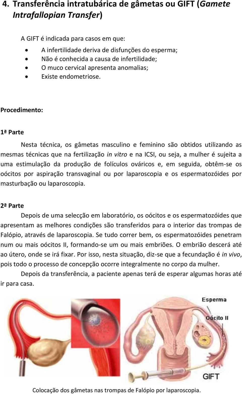 Procedimento: 1ª Parte Nesta técnica, os gâmetas masculino e feminino são obtidos utilizando as mesmas técnicas que na fertilização in vitro e na ICSI, ou seja, a mulher é sujeita a uma estimulação