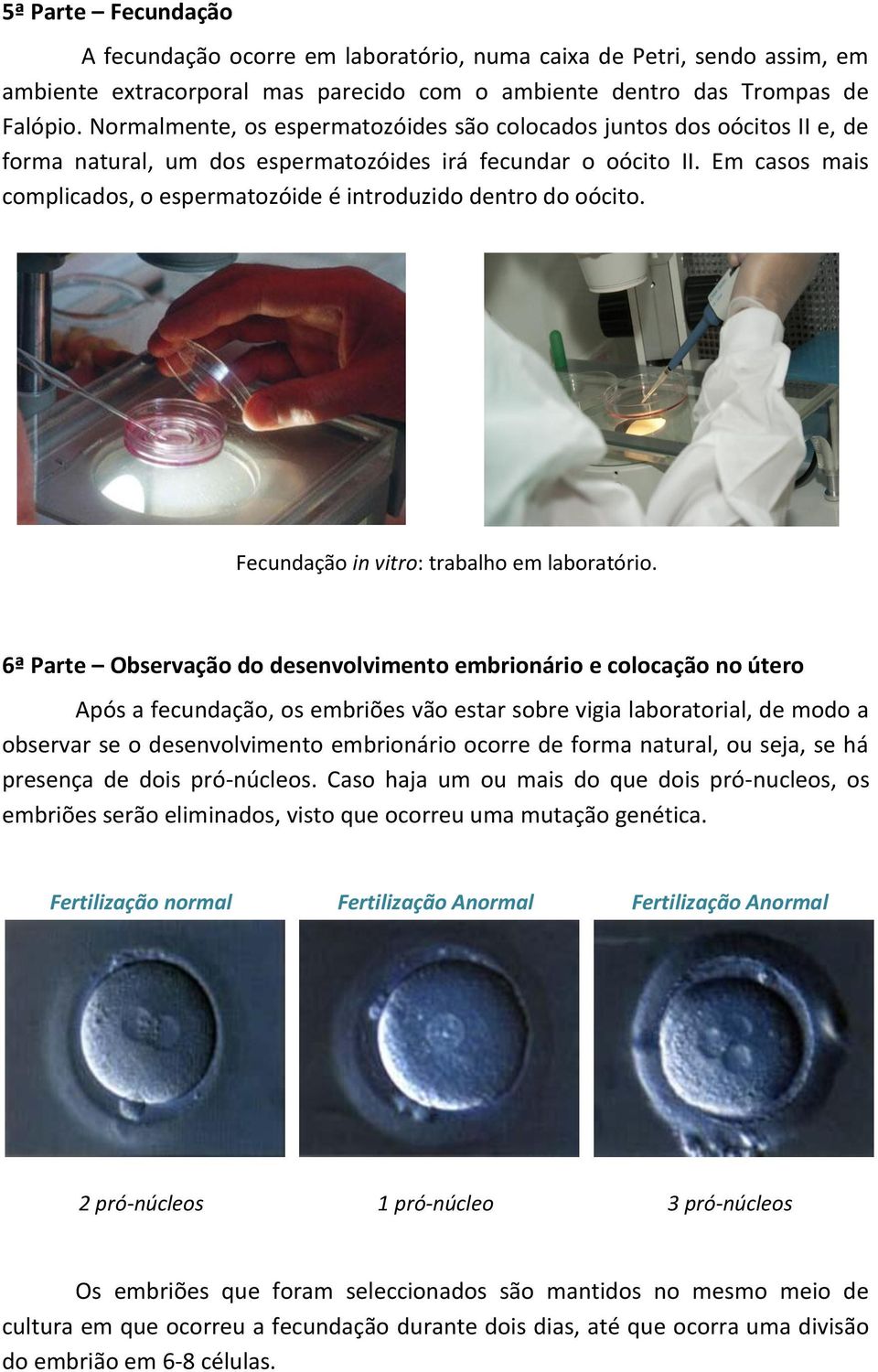 Em casos mais complicados, o espermatozóide é introduzido dentro do oócito. Fecundação in vitro: trabalho em laboratório.