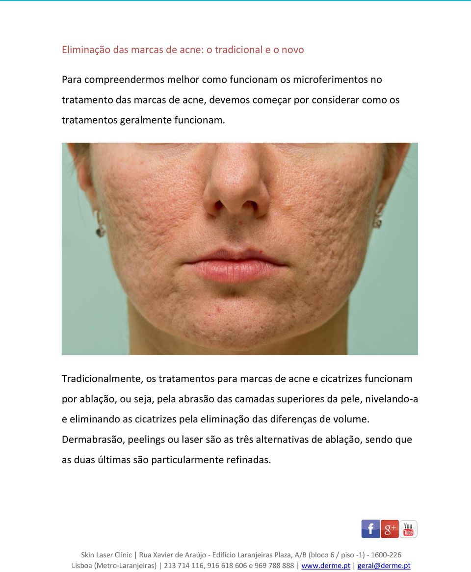 Tradicionalmente, os tratamentos para marcas de acne e cicatrizes funcionam por ablação, ou seja, pela abrasão das camadas superiores da pele,