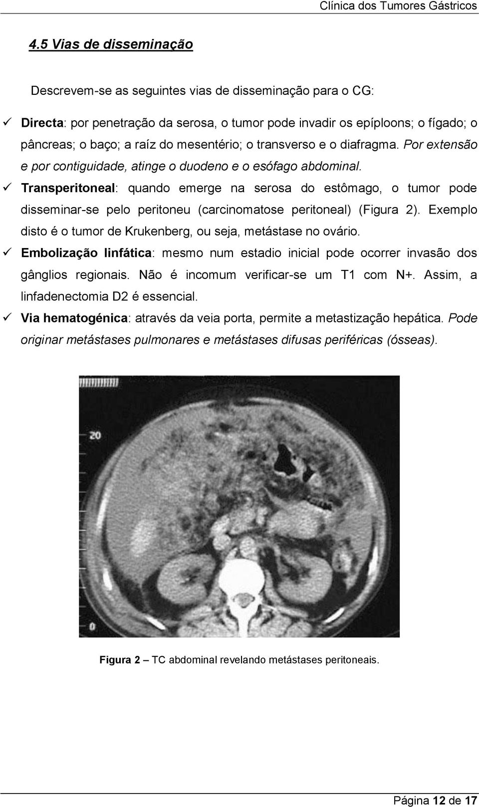 Transperitoneal: quando emerge na serosa do estômago, o tumor pode disseminar-se pelo peritoneu (carcinomatose peritoneal) (Figura 2).