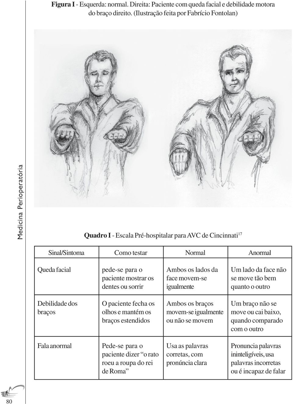 ou sorrir Ambos os lados da face movem-se igualmente Um lado da face não se move tão bem quanto o outro Debilidade dos braços O paciente fecha os olhos e mantém os braços estendidos Ambos os braços