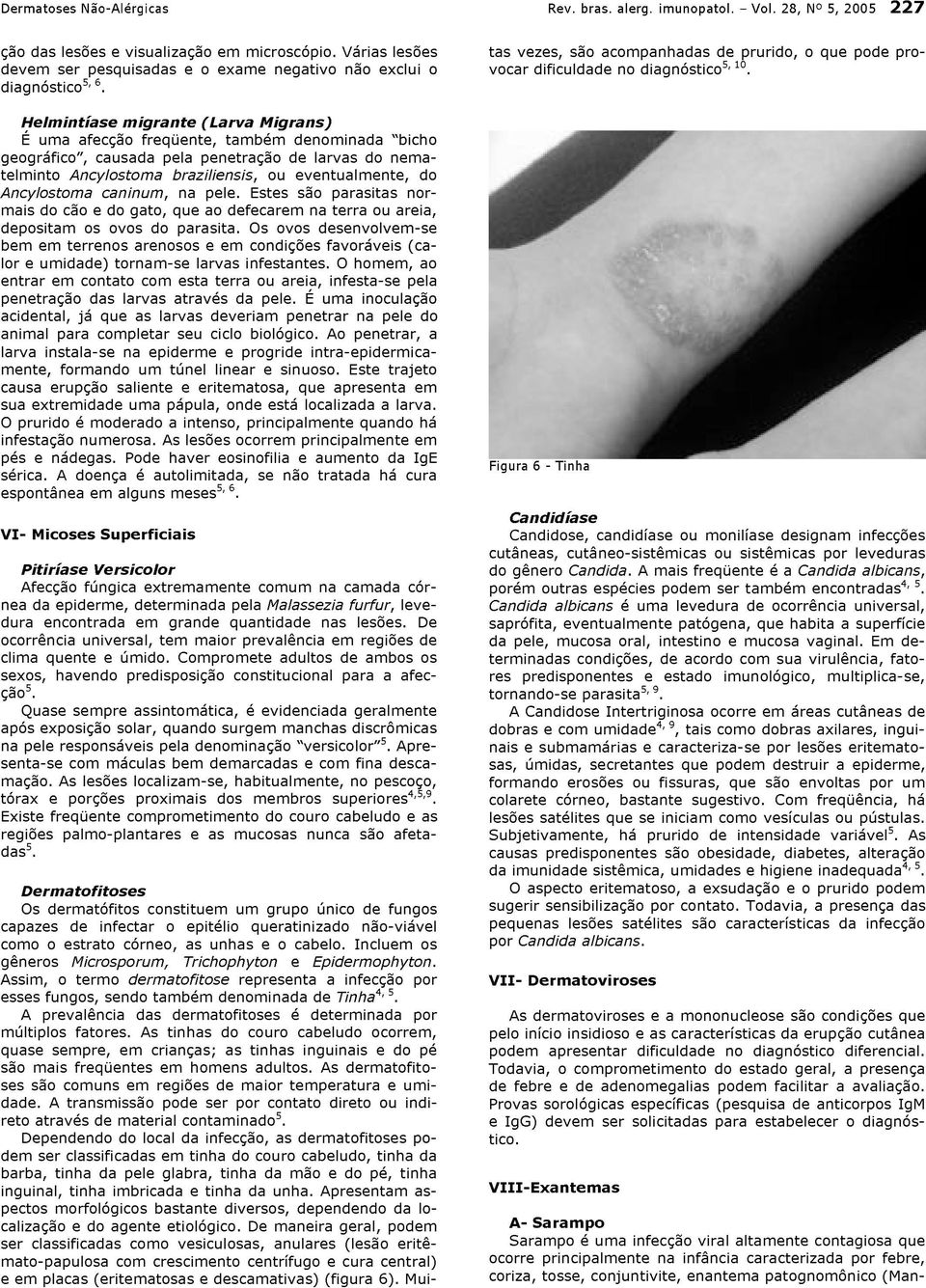 Helmintíase migrante (Larva Migrans) É uma afecção freqüente, também denominada bicho geográfico, causada pela penetração de larvas do nematelminto Ancylostoma braziliensis, ou eventualmente, do