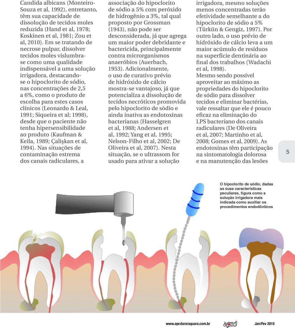 como o produto de escolha para estes casos clínicos (Leonardo & Leal, 1991; Siqueira et al; 1998), desde que o paciente não tenha hipersensibilidade ao produto (Kaufman & Keila, 1989; Çalişkan et al,